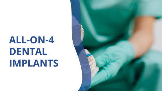 All-on-4 Dental Implants vs. Traditional Implants All on 4 implants